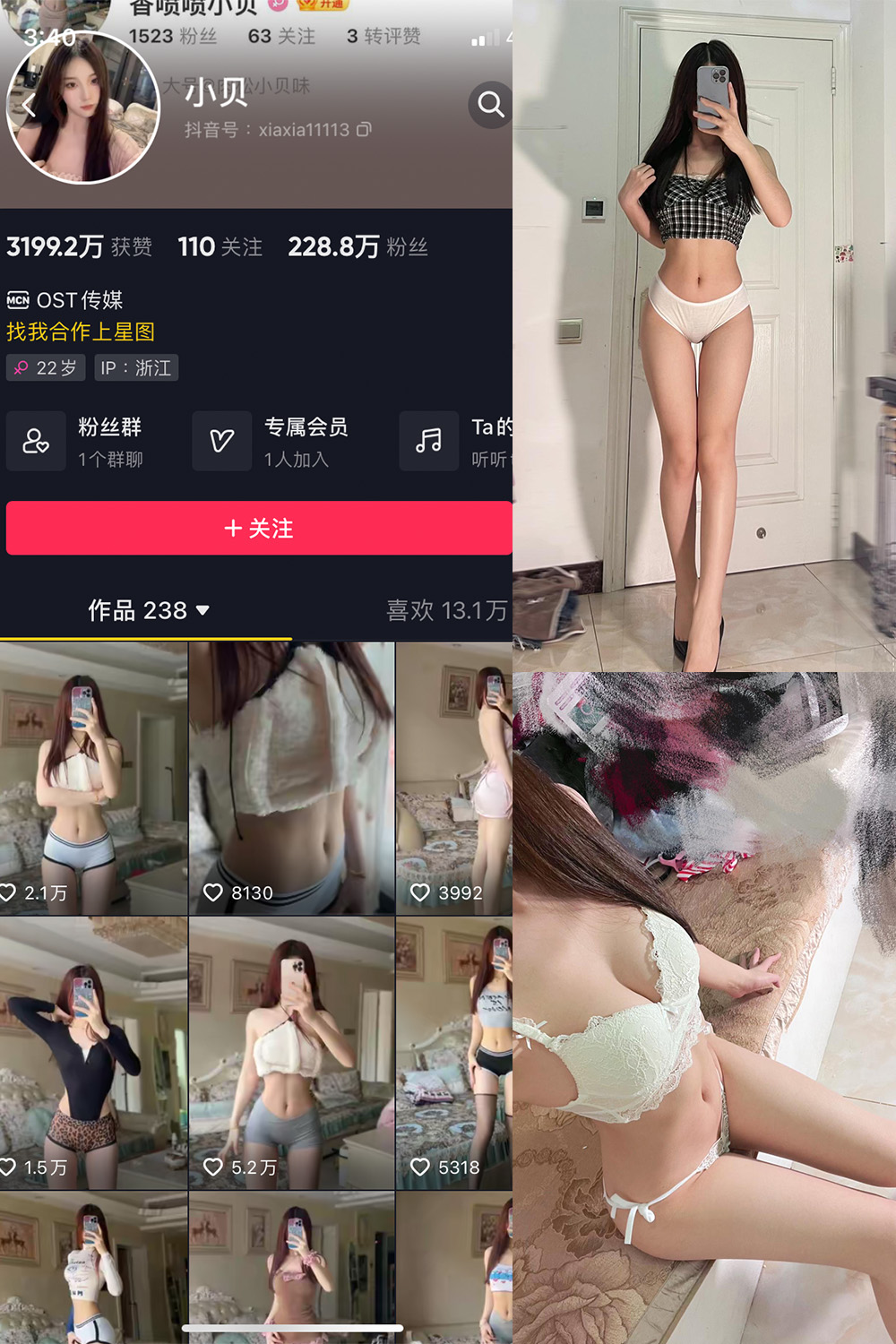 抖音 小贝 VIP 微密圈 NO.012期 【25P4V】  小贝VIP 第1张