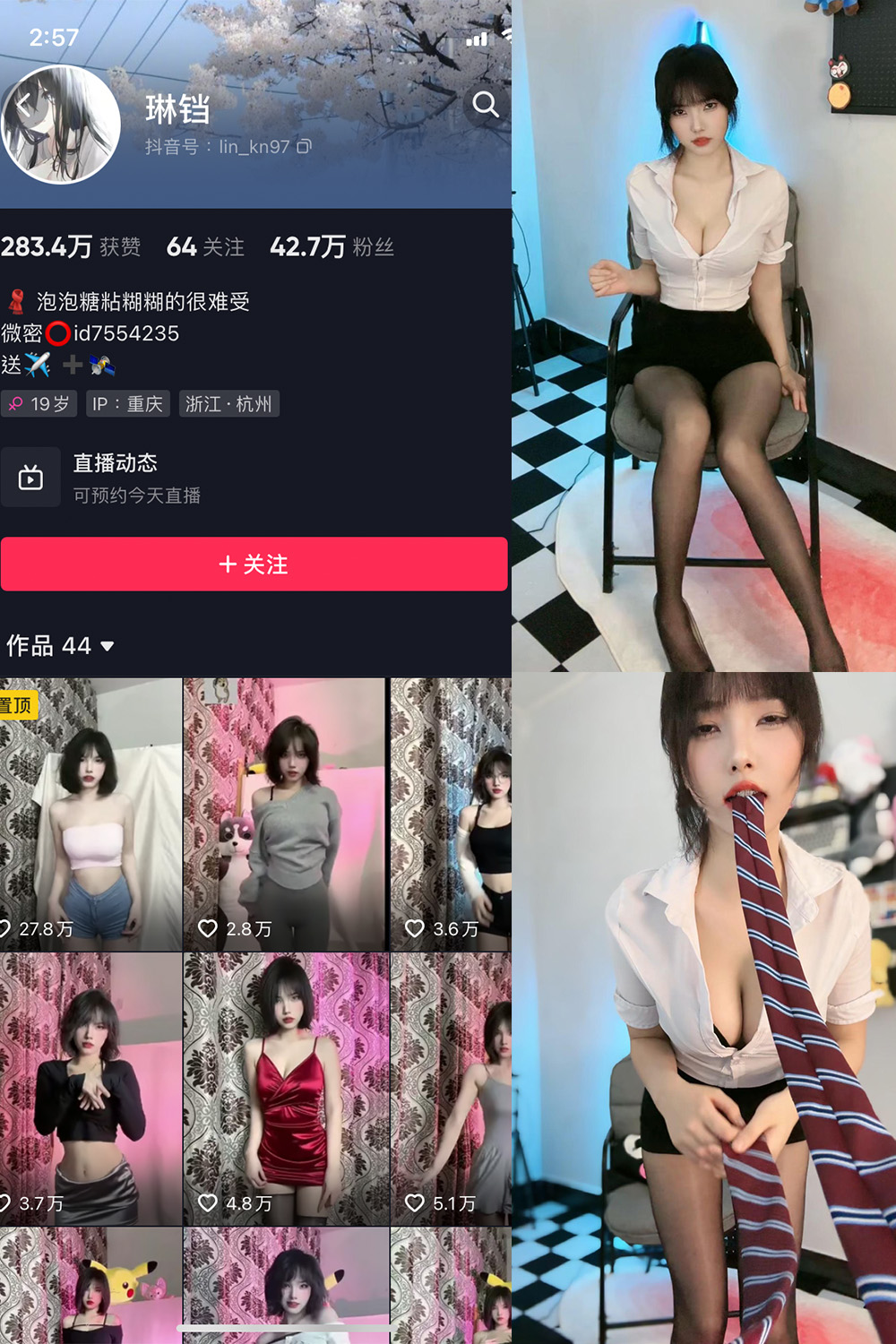 抖音 琳铛 微密圈  NO.020期 【21P】最新至：2023.6.16 第1张